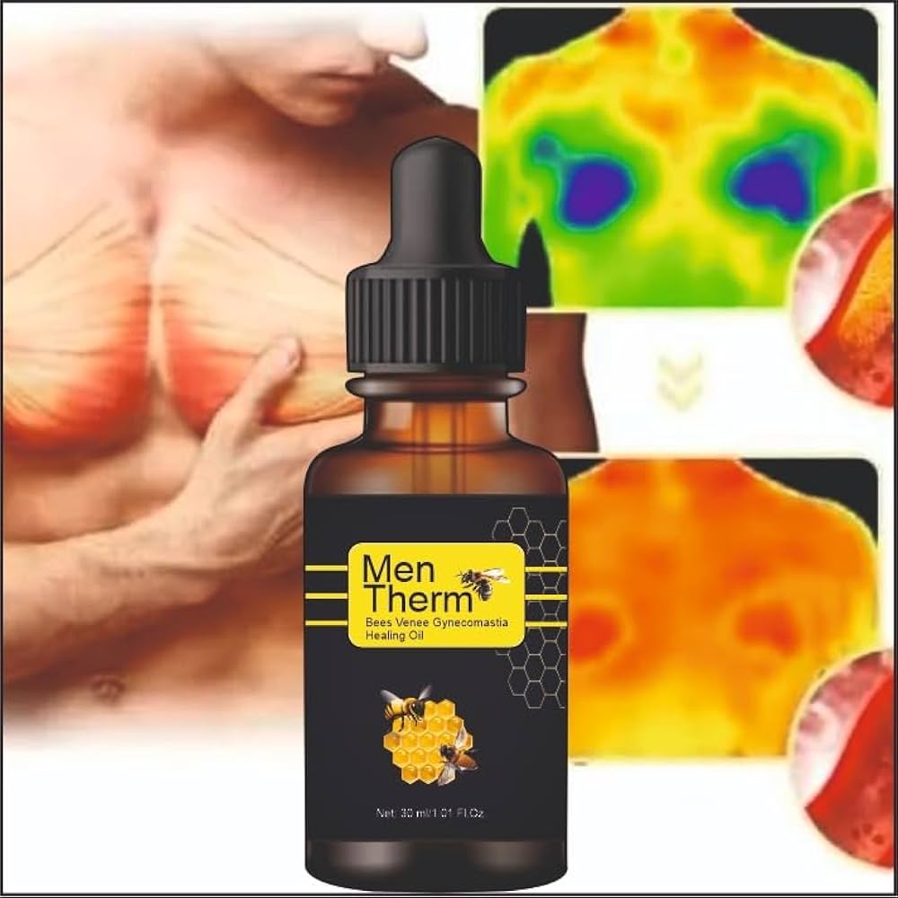 Men Therm Bee Venom Gynecomastia Heating Oil.