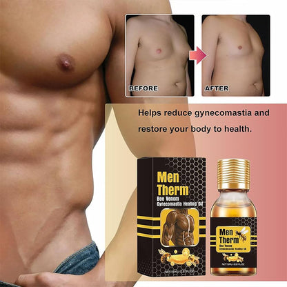 Men Therm Bee Venom Gynecomastia Heating Oil.