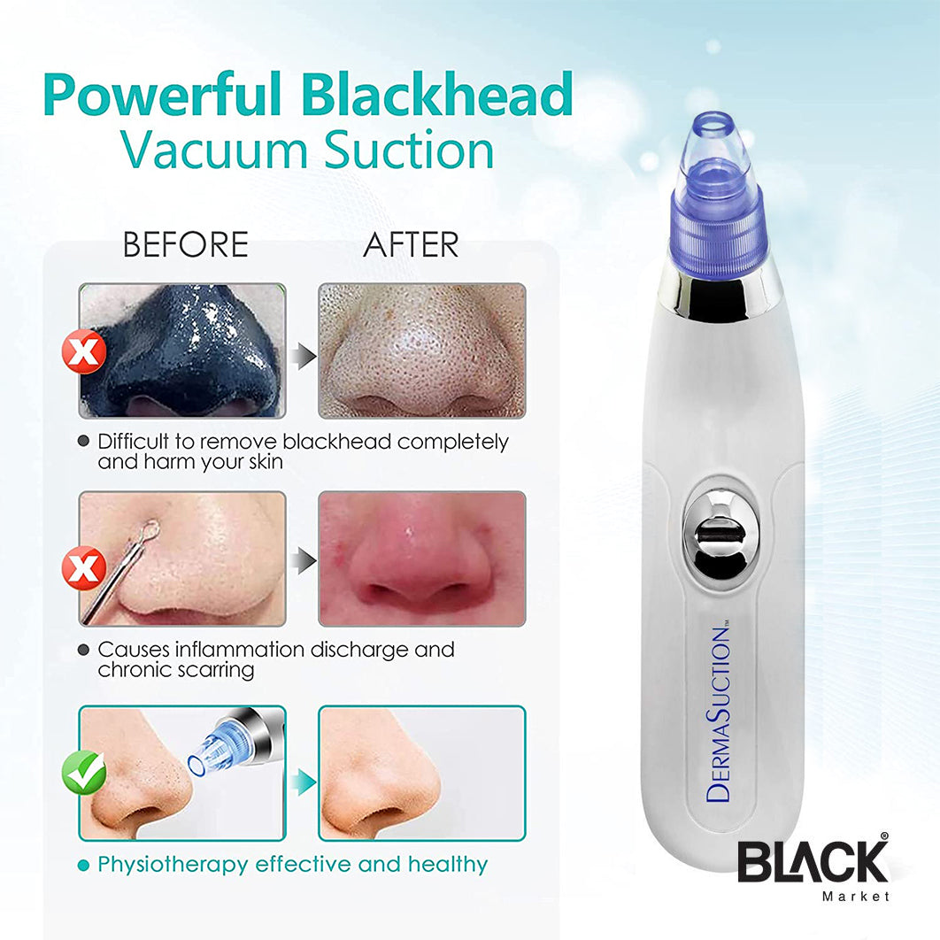 Blackhead Removal Machine 6 In 1 Rechargeable Machine