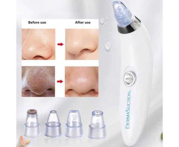 Blackhead Removal Machine 6 In 1 Rechargeable Machine