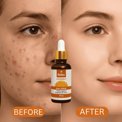 Relax Vitamin C Face Serum 30ml – Skin Brightening, Anti-Aging, Dark Spot Removal & Glow Booster
