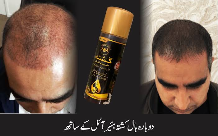 Kushta Hair Oil (Booster)